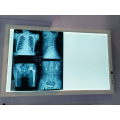 Ultra Thin Single Panel LED Xray Film Viewer Negatoscope